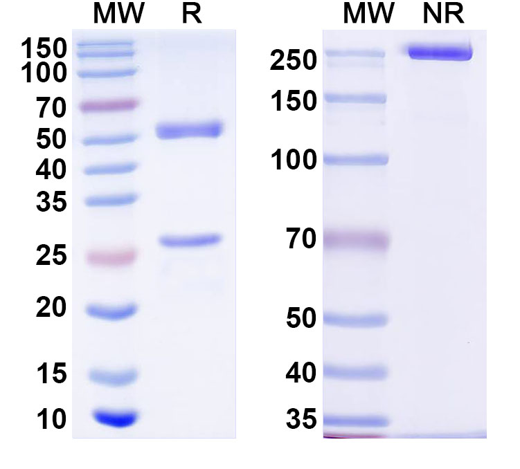 SDS-PAGE for Anti-Human ZBTB41 Antibody (C202)