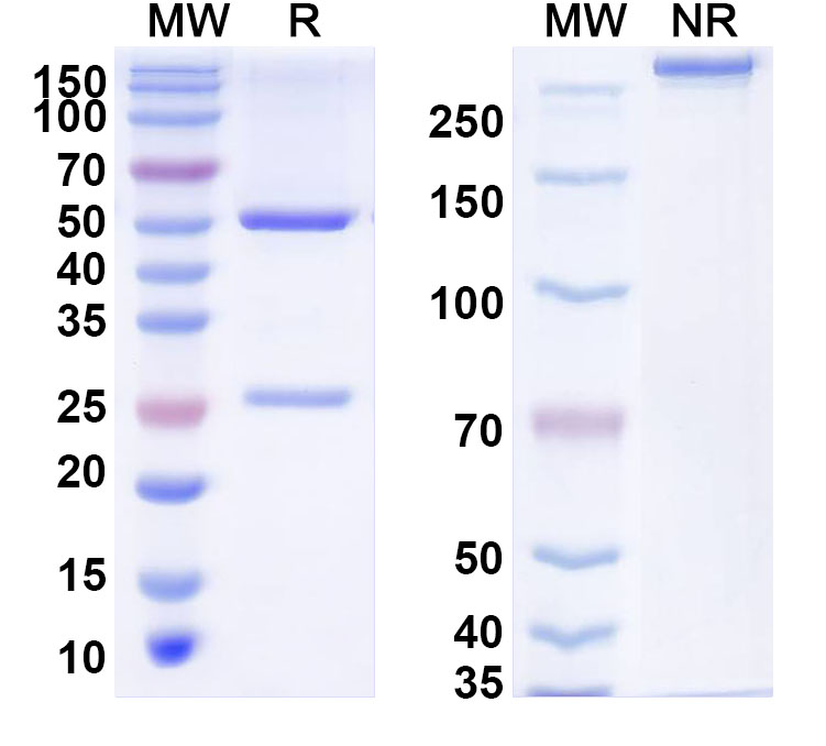 SDS-PAGE for Anti-Human ZHX1 Antibody (C63)