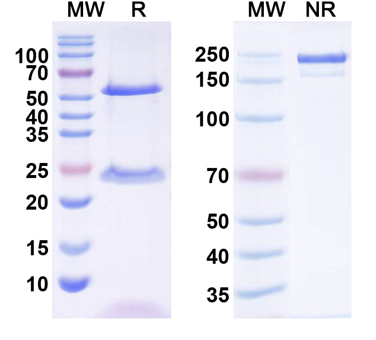 SDS-PAGE for Anti-ICK Antibody (N451/29)