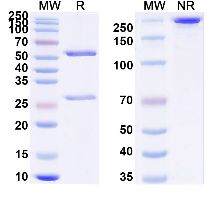 SDS-PAGE for Anti-Influenza A virus Neuraminidase/NA protein Antibody (SAA1424)