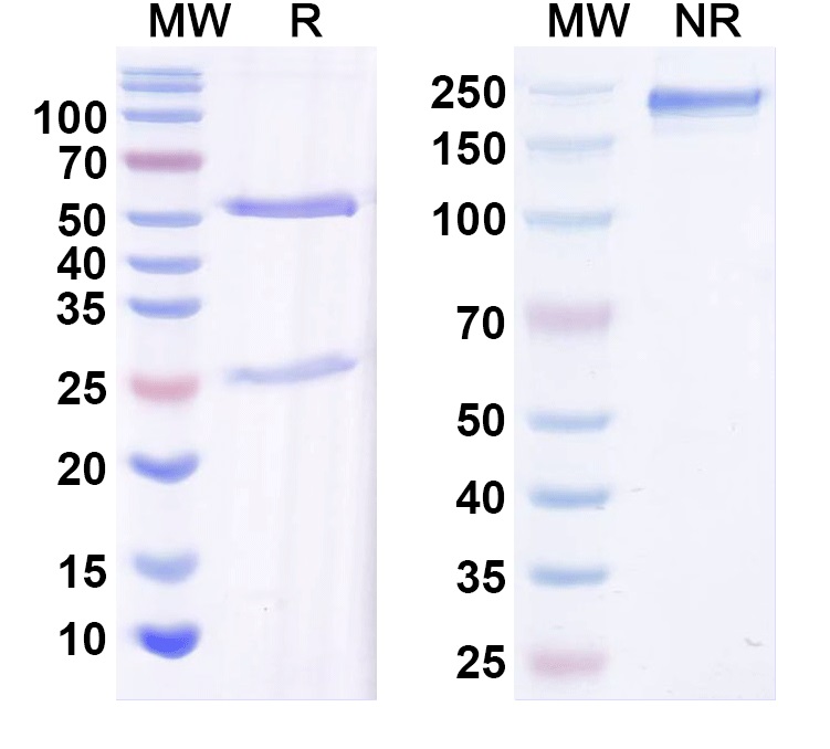 SDS-PAGE for Anti-Kvbeta2 K+ channel Antibody (K17/70)