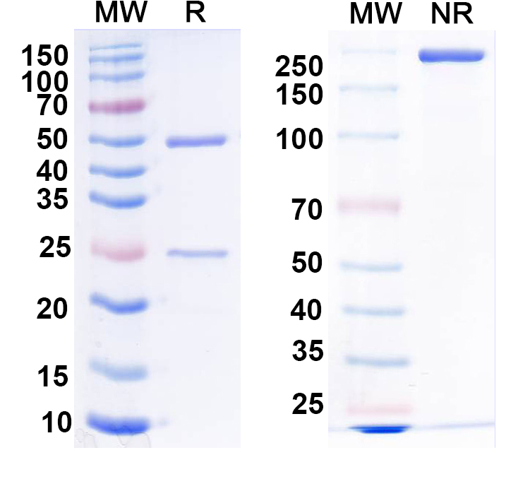 SDS-PAGE for Anti-LRRTM2 Antibody (N209B/31)