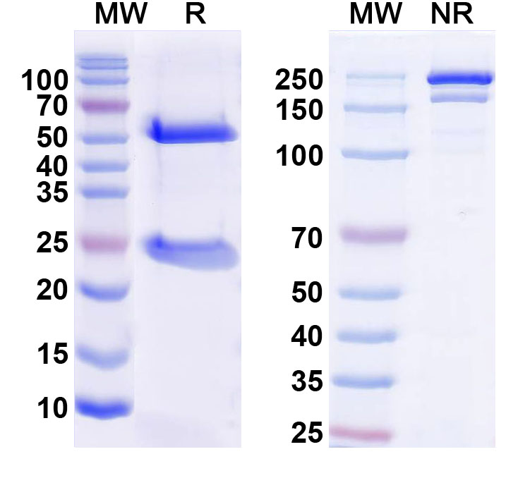 SDS-PAGE for Anti-MPP8 Antibody (N119/46)