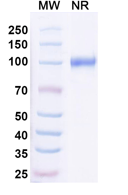 SDS-PAGE for Anti-Neisseria meningitidis NadA/Neisseria adhesin A Antibody (G9)