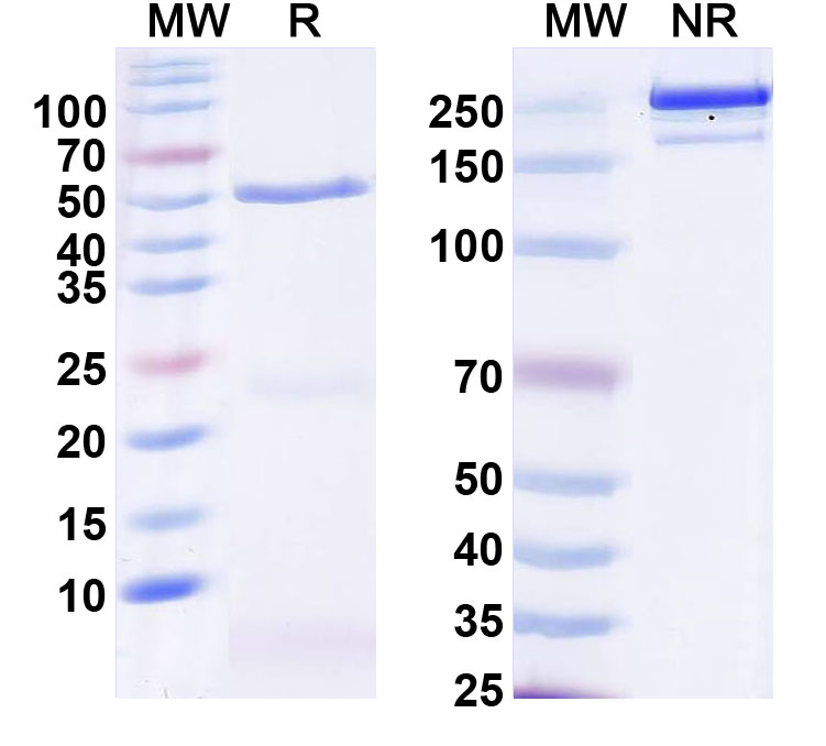 SDS-PAGE for Anti-Neurabin-1/Ppp1r9a Antibody (L129/88)