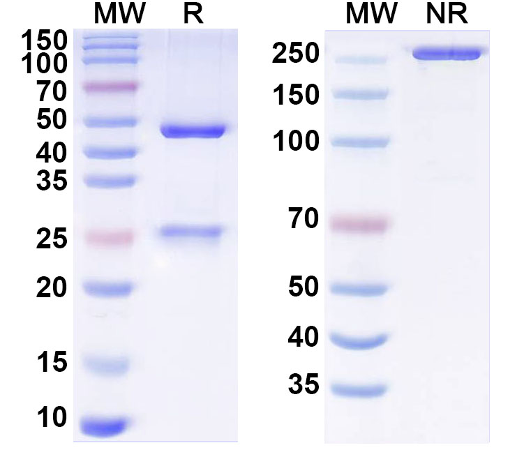 SDS-PAGE for Anti-Opisthorchis viverrini Paramyosin Antibody (SAA1447)