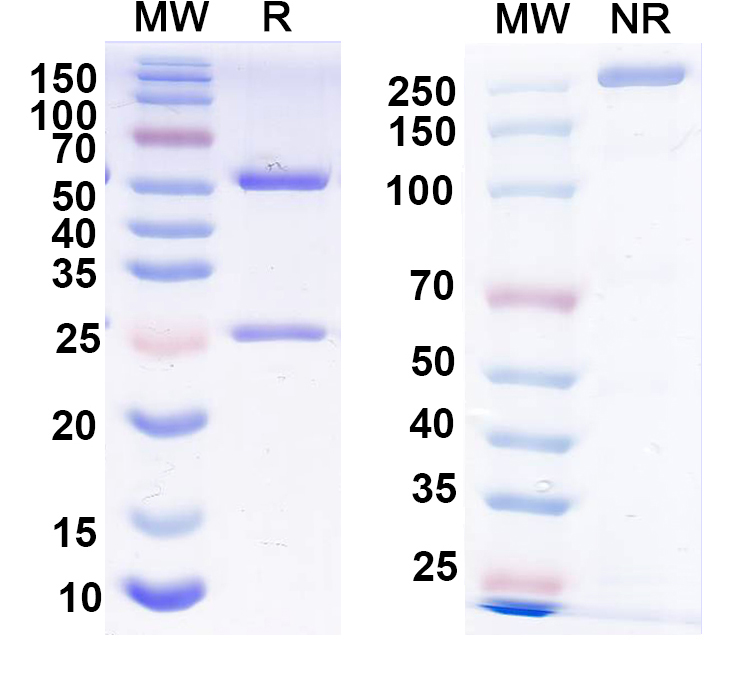 SDS-PAGE for Anti-P2X purinoceptor 4 Antibody (N368/51)