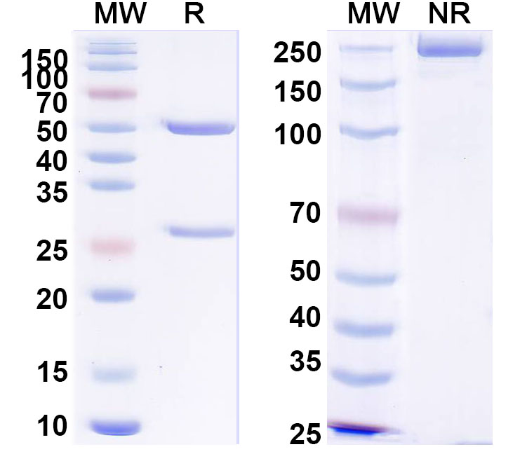 SDS-PAGE for Anti-PHLPV/Allergen Phl p V Antibody (SAA0711)