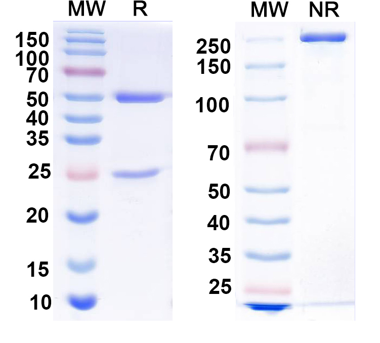 SDS-PAGE for Anti-Parainfluenza virus 5/PIV5 Protein P Antibody (SAA0288)
