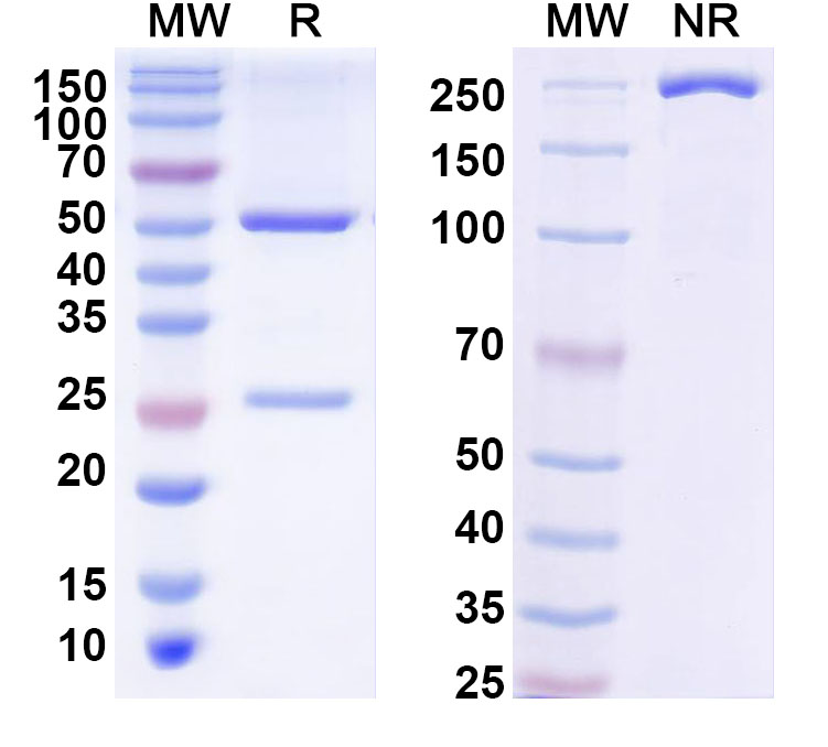 SDS-PAGE for Anti-Phospho-Tau (pS202) Antibody (CP13)