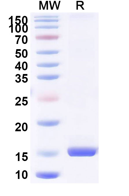 SDS-PAGE for Anti-Porphyromonas gingivalis porM Nanobody (SAA0966)