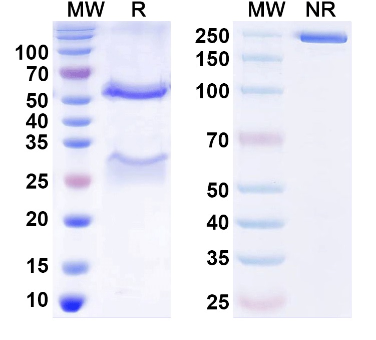 SDS-PAGE for Anti-Prrt2 Antibody (N485/22)