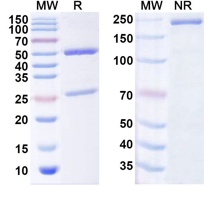 SDS-PAGE for Anti-Pseudomonas aeruginosa PcrV Antibody (SAA1988)