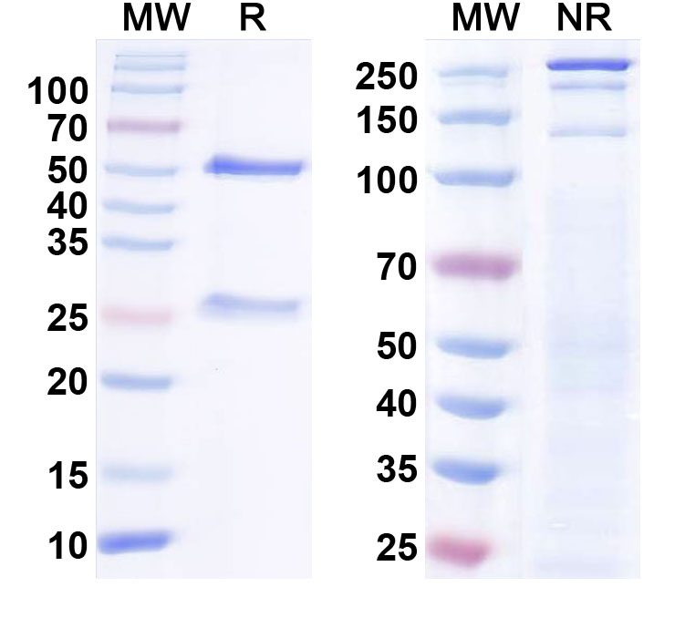 SDS-PAGE for Anti-SAP102 Antibody (N19/2)
