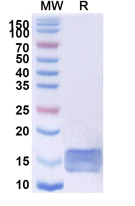 SDS-PAGE for Anti-SARS-CoV-2 S Protein Nanobody (SAA0964)
