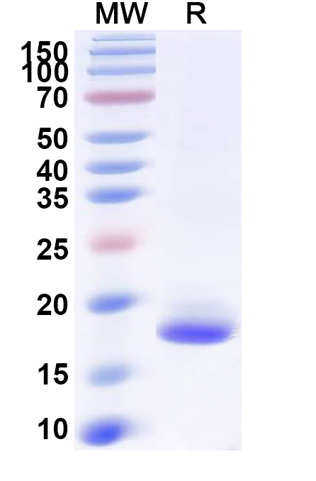 SDS-PAGE for Anti-SARS-CoV-2 S Protein Nanobody (SAA0970)