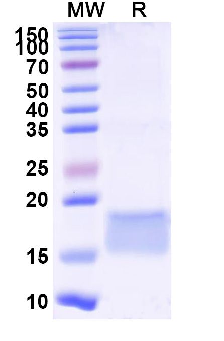 SDS-PAGE for Anti-SARS-CoV-2 S Protein Nanobody (SAA0974)