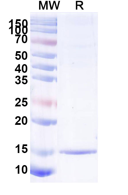 SDS-PAGE for Anti-SARS-CoV-2 S Protein Nanobody (SAA1060)