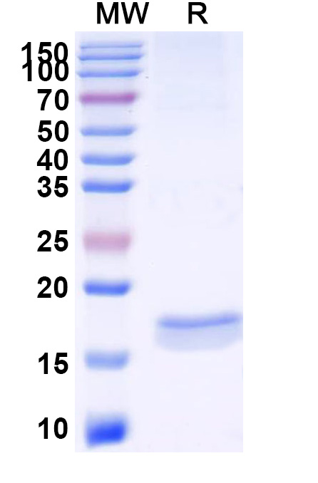 SDS-PAGE for Anti-SARS-CoV-2 S Protein Nanobody (SAA1067)