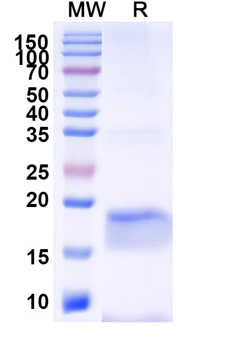 SDS-PAGE for Anti-SARS-CoV-2 S Protein Nanobody (SAA1077)