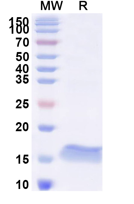 SDS-PAGE for Anti-SARS-CoV-2 S Protein Nanobody (SAA1081)