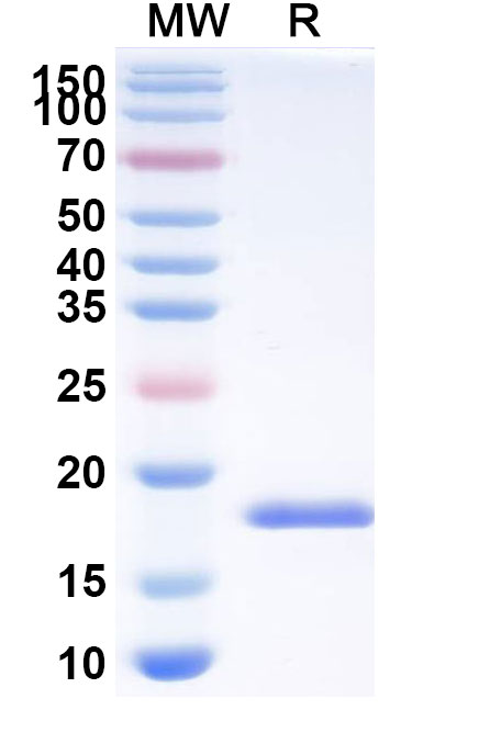 SDS-PAGE for Anti-SARS-CoV-2 S Protein Nanobody (SAA1122)