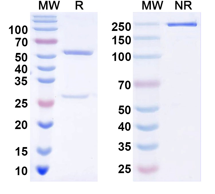 SDS-PAGE for Anti-Slo2.1/Slick K+ channel Antibody (N11/33)