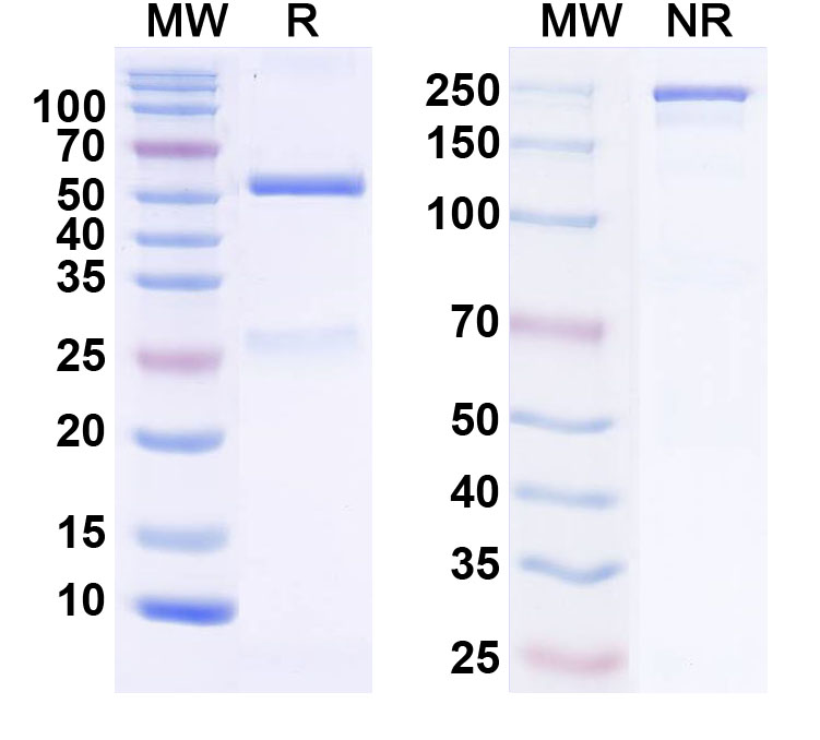 SDS-PAGE for Anti-THIK-2 K+ channel Antibody (N468/39)