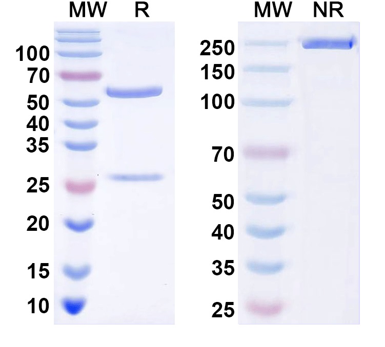 SDS-PAGE for Anti-TRESK K+ channel Antibody (N467/79)