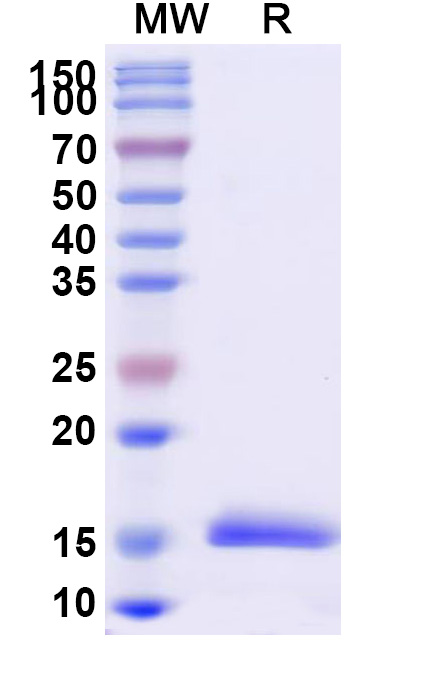 SDS-PAGE for Anti-Vesicular stomatitis Indiana virus/VSIV NP/Nucleoprotein Nanobody (SAA1125)