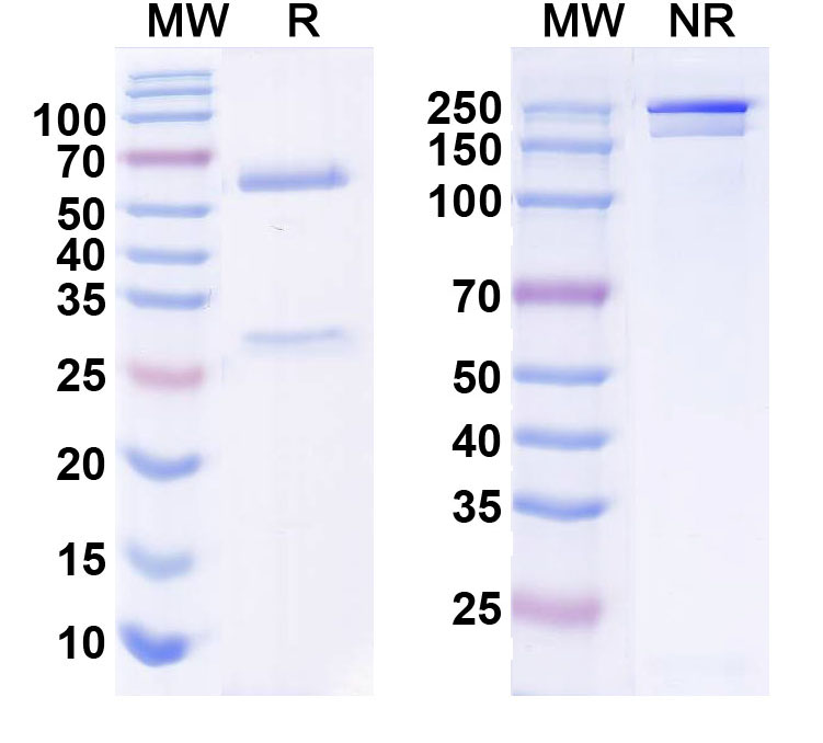 SDS-PAGE for Anti-WNK3 Antibody (N392/9)