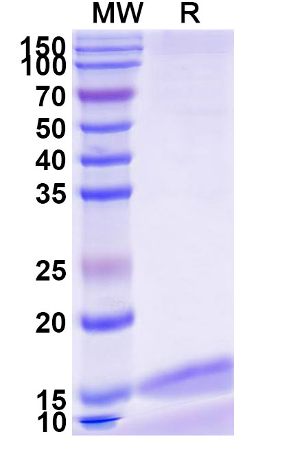 SDS-PAGE for Anti-Zaire ebolavirus/ZEBOV GP/GP1, 2 Nanobody (SAA1248)
