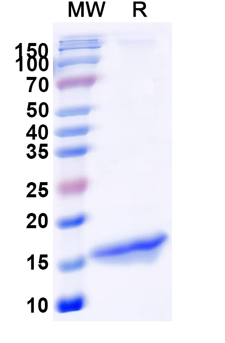 SDS-PAGE for Anti-GFP Nanobody (SAA0975)