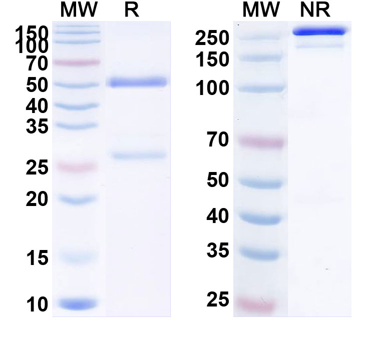 SDS-PAGE for Anti-Human SAA Monoclonal Antibody (1A323)