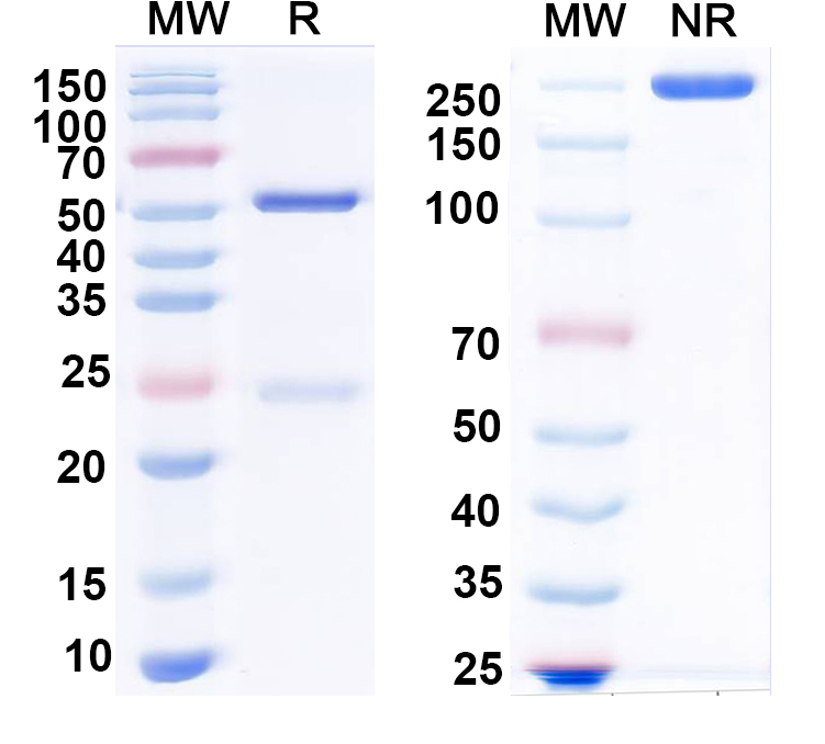 SDS-PAGE for Anti-Influenza B virus/Flu-B virus Monoclonal Antibody (1A260)