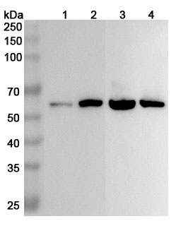 Western blot for Anti-ALDH7A1 Polyclonal Antibody