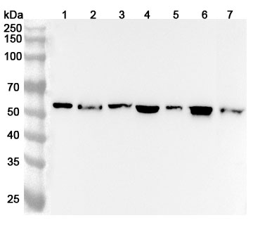 Western blot for Anti-FGB/Fibrinogen beta Polyclonal Antibody