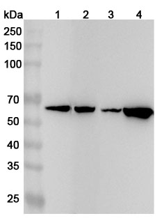 Western blot for Anti-Human G6PD Polyclonal Antibody