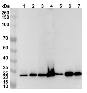 Western blot for Anti-Human RPA2 Polyclonal Antibody
