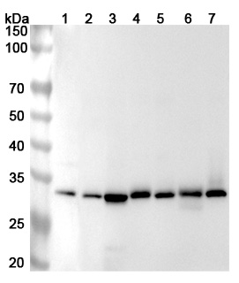 Western blot for Anti-Human RPA2 Polyclonal Antibody
