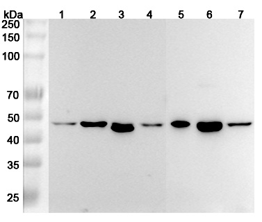 Western blot for Anti-Human RSAD2 Polyclonal Antibody
