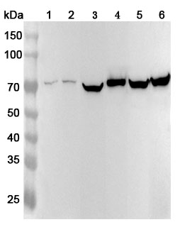 Western blot for Anti-Human SLC25A12 Polyclonal Antibody