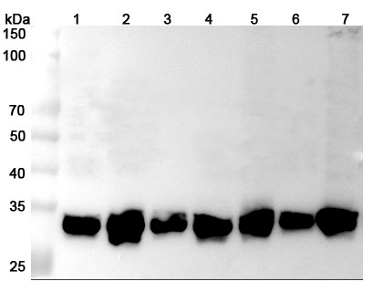 Western blot for Anti-Human YWHAE Polyclonal Antibody