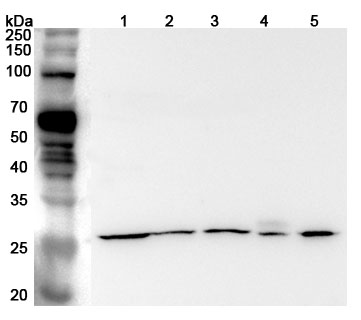 Western blot for Anti-Mouse APCS Polyclonal Antibody