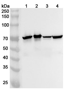 Western blot for Anti-NEFL Polyclonal Antibody