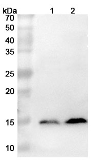 Western blot for Anti-S100A9 Polyclonal Antibody